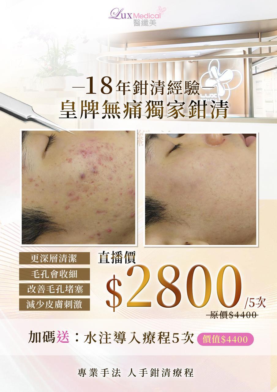 【直播價】皇牌無痛獨家鉗清療程 5次（送水注導入療程5次）